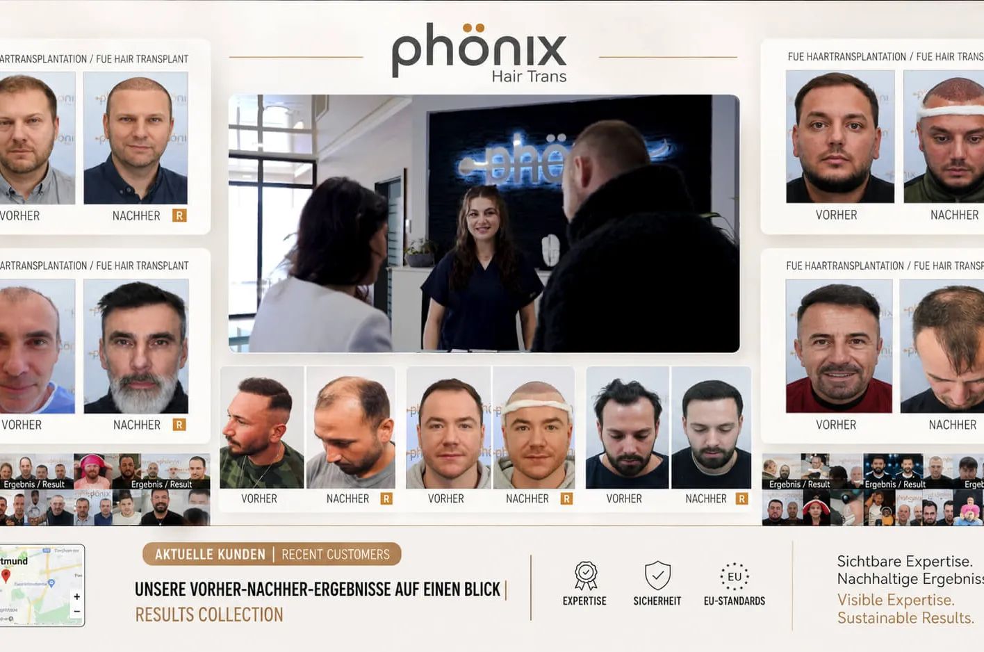 Echte Transformationen aus Dortmund: Vorher-Nachher-Ergebnisse von Phönix Hair Trans