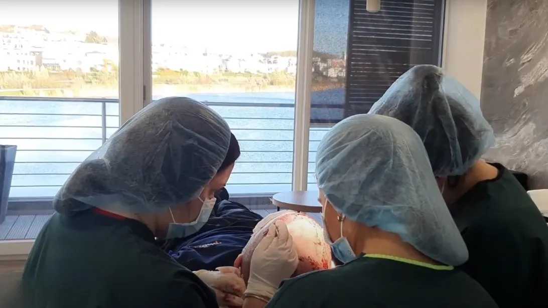 Haarausfall verstehen: Ursachen, Diagnose und moderne Behandlungsansätze