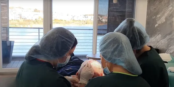 Haarausfall verstehen: Ursachen, Diagnose und moderne Behandlungsansätze