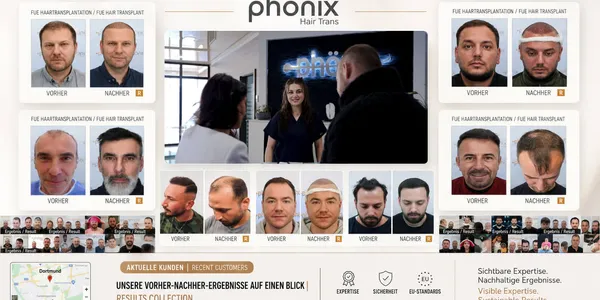 Echte Transformationen aus Dortmund: Vorher-Nachher-Ergebnisse von Phönix Hair Trans