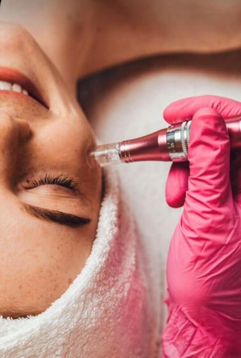 Medizinisches Microneedling