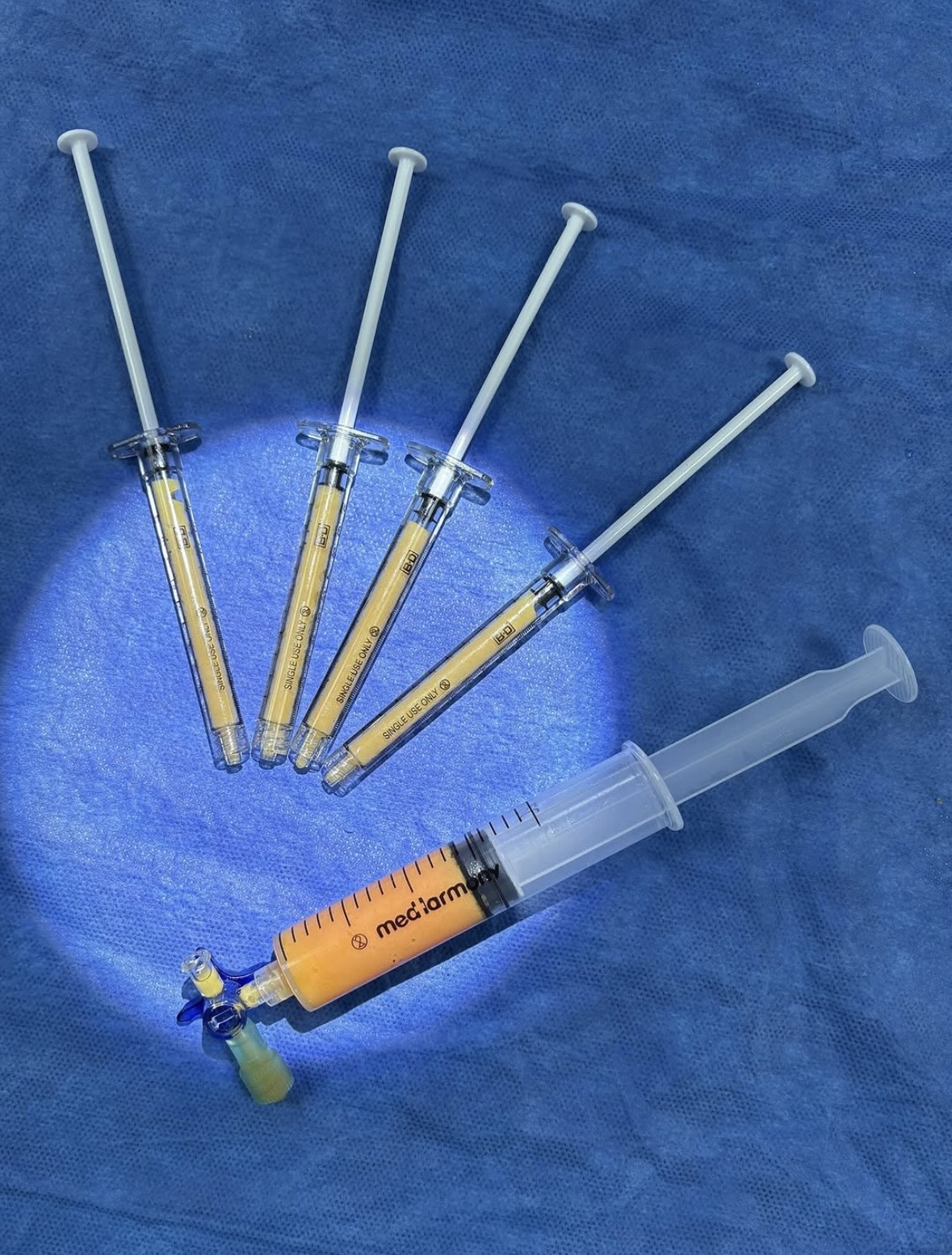 Nanofat-Eigenstammzelltherapie